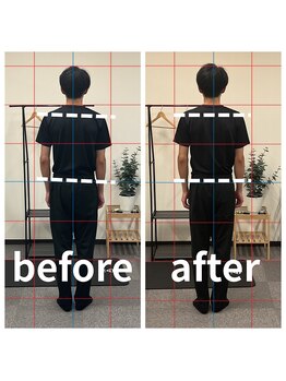 熊本カワル整体 JR上熊本駅院/姿勢調整