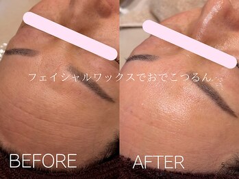 ケアズ(CARES)/フェイシャルワックス