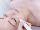 beauty salon からだ美人の写真/【結果が目に見えてわかるシミケア☆】痛みの少ない低周波ペンシルでシミにピンポイントでアプローチ♪