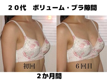 バストサロン メルベイユ(Merveile)/デコルテから丸みUP、隙間埋まる