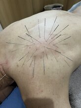 せせらぎ鍼灸院/