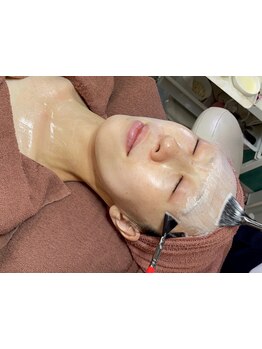 美白ケアをしたい