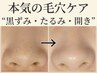 【韓国ツヤ肌◎毛穴レス◎】ずっと気になるその毛穴!ツルッと体験¥4,400