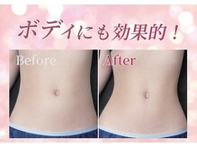 リフト 藤沢(Lift)の雰囲気（【個室で安心★】コテ/アメニティご用意◎[小顔/藤沢]）