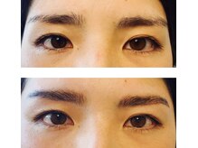 アビー(Abbey)/ハリウッドブロウリフト