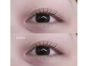 フィールリファイン(Feel Refine)/ラッシュリフト