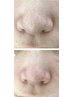 【眉毛とお鼻ケア】眉毛デザインWAX×鼻の強力毛穴洗浄 16000→13500