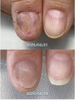 ポメロ(POMELO)/約１ヶ月の変化です