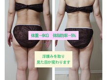 ヨサパーク ミミ 高野店(YOSA PARK mimi)の雰囲気（ルルオンは痩身と美白！鏡を見るたび嬉しくなる♪）