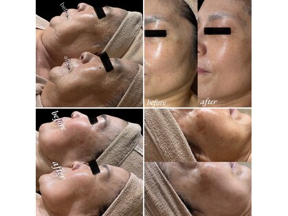 スプレミア(spuremia)の写真