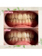 パルティービューティー 天満店(PARTIE BEAUTY)/お客様の変化をお届け【No.2】