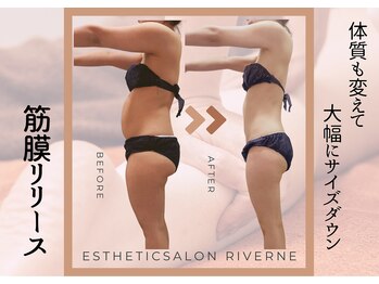 リヴェーヌ 富山店の写真/【8000人突破】リヴェーヌ式筋膜リリースは10年以上愛されるだけの結果を生み出す！