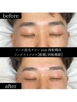 ユー 西船橋店(you)/ビフォーアフター写真