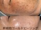 ルーク(Luke)の写真