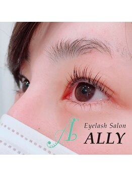 アリー(ALLY)/