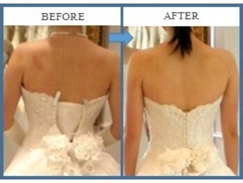 グラン イーノDAY SPA クレフィ三宮店/ブライダルエステについて4