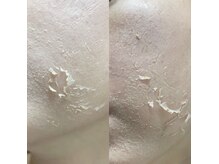 グラナーダ(granada)/ハーブトリートメント