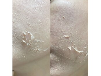 グラナーダ(granada)/ハーブトリートメント