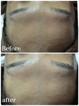 ジョリーズ(jolie's)/ハーブエステで艶肌