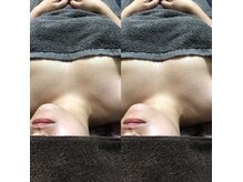 美ラックス 山室店(美LUX)の雰囲気（脱毛も）