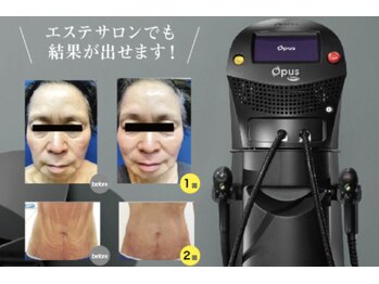 ハッピーハンド(HAPPY HAND)/新型サーモシェイプOpus導入！