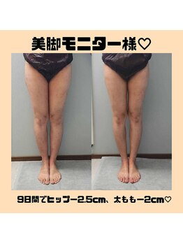 ルミルナ(Lumi Luna)/9日間の超短期で隙間！