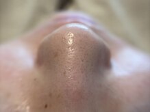 リセットプラス(Reset+)/