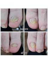 爪切り屋 足楽/