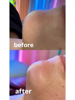 エフ ワクシングブティック(efu.WaxingBoutique)/フェイシャルフル¥7,700