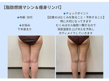 ビオルブ(VIOLVE)/痩身/ダイエット/むくみ改善