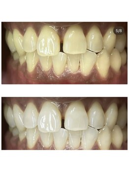 トータルビューティー エヌ プラス(total beauty n+)/Before ⇒ After