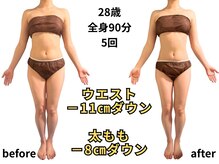 アルピナ(ALPINA)/全身サイズダウン例