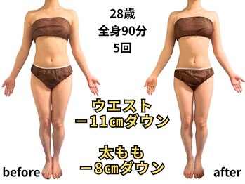 アルピナ(ALPINA)/全身サイズダウン例