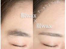 ブラン 磐田店(Blanc)/おでこWAX