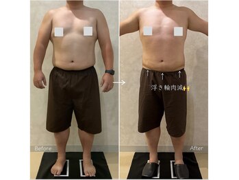 OBS新潟整骨院/男性にも大人気　OBSの脂肪冷却