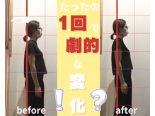 栄光治院 整体院東岡崎の雰囲気（猫背矯正のビフォーアフターです【岡崎/整体/猫背/肩こり/産後】）