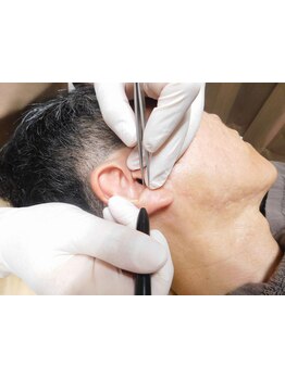 デリケート部分の脱毛/Vライン/VIO