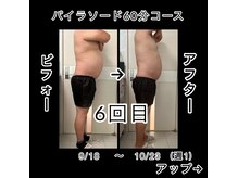 エステティックサロン ナゴミ(和)の雰囲気（痩身パイラソード　）