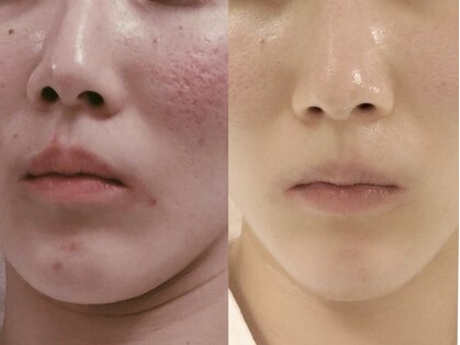 デンドロビューム(Dendrobium)の写真