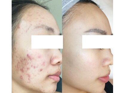 エム 銀座(M)の写真