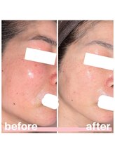 プリマ 大津店(PRIMA)/ゆらぎ肌・くすみ肌の１年後☆