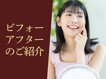 クオレ(Cuore)/ビフォーアフターのご紹介！