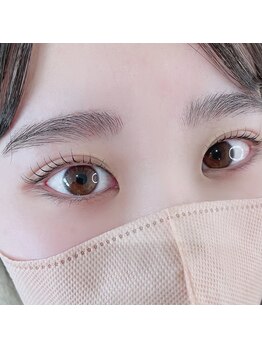 オルト(ORT)/ラッシュリフト