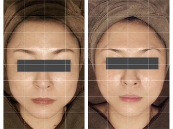 サロン リーナ 北千住店(Salon Lena)/商標登録手技★骨造コルゾウ