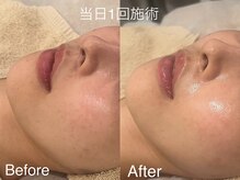 シェリーミル(Cherie Miru)/赤み・くすみ・毛穴ケア