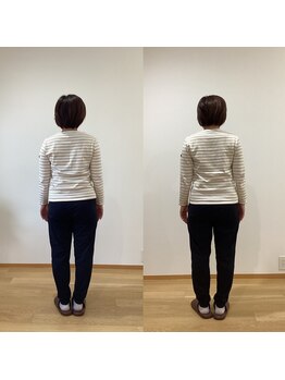 ランドル(rendre)/40代女性　脊柱の弯曲　姿勢改善