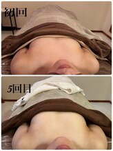 シャルマン(Charmant)/befoer、after 