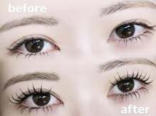 ロピ 江坂(LOPI)/&Healthy(アンドヘルシー)100本