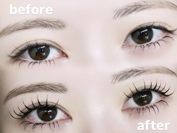 ロピ 江坂(LOPI)/&Healthy(アンドヘルシー)100本