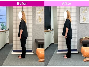 八女整体院/~姿勢改善~首・肩の痛み